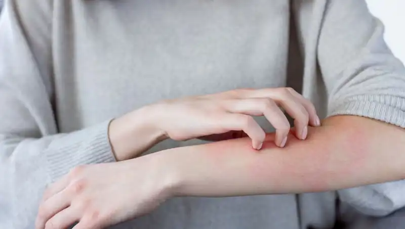 Gözden Kaçırılan 2 Belirti: Dermatolog Cilt Kanserini Açıkladı
